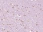 PTPRS Polyclonal Antibody